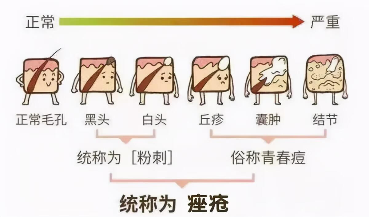 脸部长痘对应五脏的图靠谱吗(五官长痘痘对应原因)