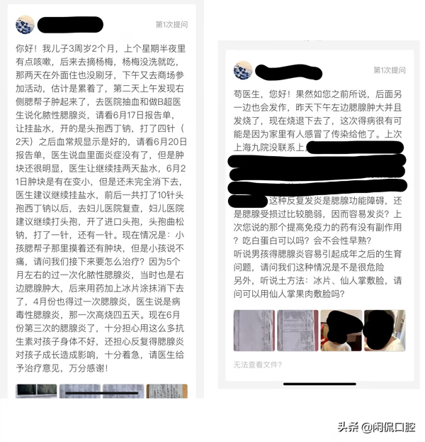 急性腮腺炎的治疗(腮腺炎最有效的治疗方法)