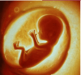 22周胎儿肾积水怎么办(胎儿肾积水是怎么引起的)