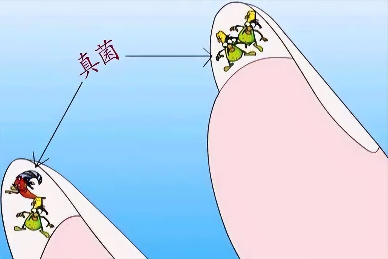 艾滋病感染(中国艾滋病至少一千万以上)
