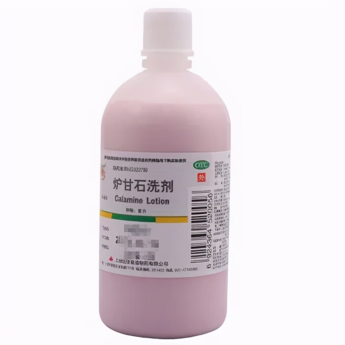外瘙痒用什么药好(外阴瘙痒用什么药最管用)