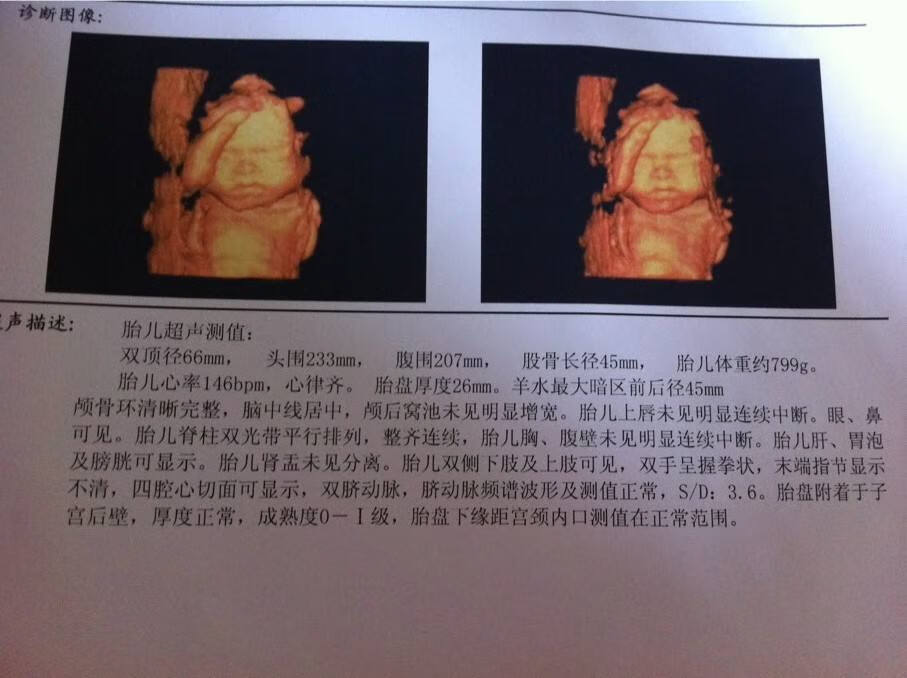 三维彩超什么时候做最好(几个月做三维彩超是最佳时期)