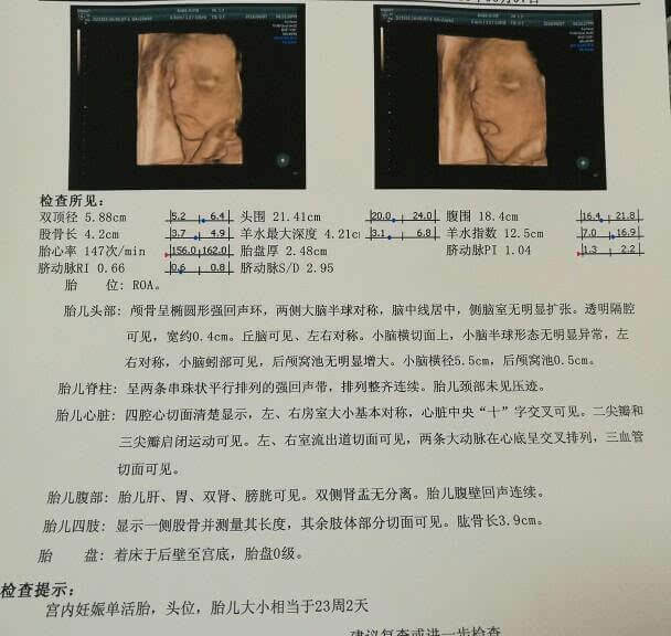 四维彩超什么样的(四维彩超是怎样的图片)