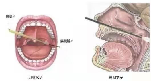 新冠核酸检测阳性什么意思(核酸检测阳性一定是新冠吗)