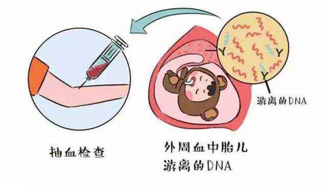無創產前基因檢測范圍(無創產前基因檢測方法)
