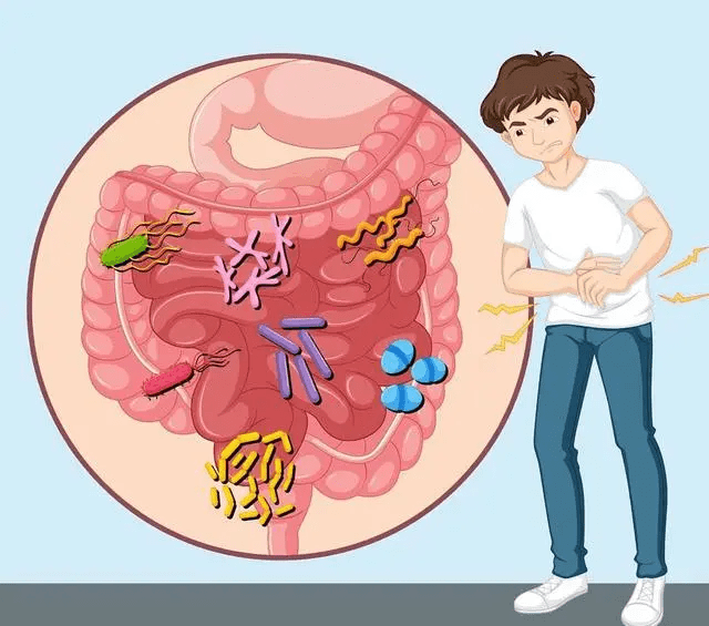 肠炎的表现(常见肠炎症状)