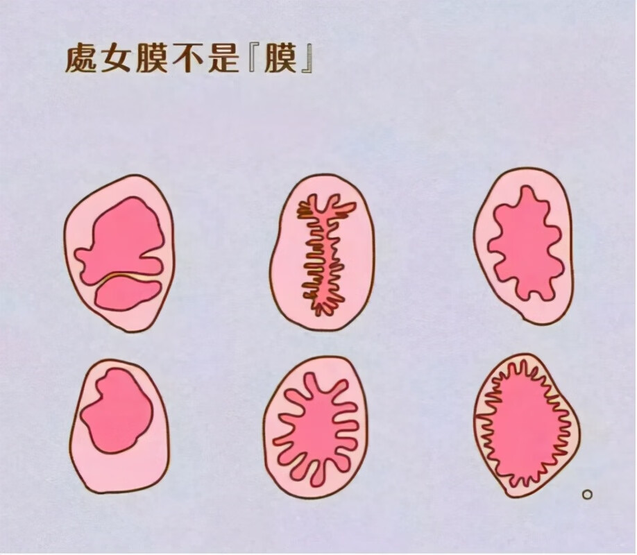 处钕膜(处nu膜是什么)