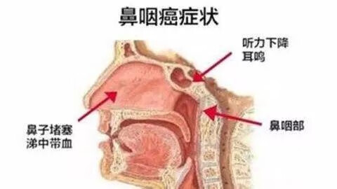 肺癌肝癌传染吗(肝癌会传染给家人吗?)