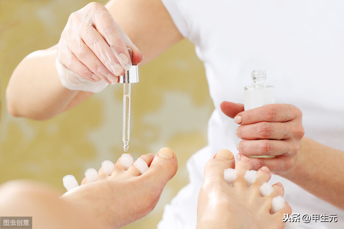 灰指甲怎么治疗(灰指甲如何快速治好)