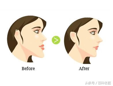 牙齿畸形有哪几种(牙齿畸形的四种类型)