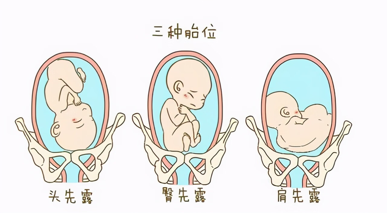 怀孕27周正常胎位图图片