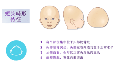 畸形婴儿图片(畸形图片)