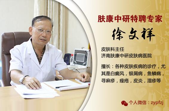 牛皮血癣会遗传吗(牛皮皮癣能传染)