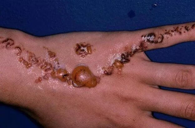 海娜粉有毒吗对不对(海娜粉对人体有没有害)
