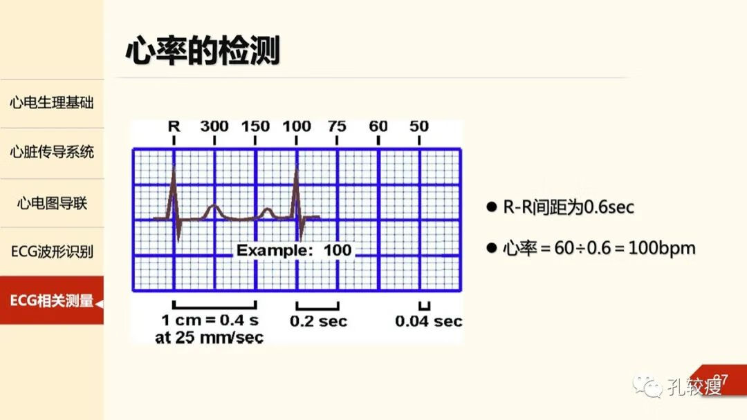 心电图导联位置示意图(心电图机导联位置图)