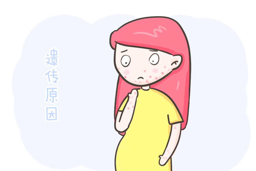 宝宝湿疹是什么原因造成的(宝宝身上有湿疹怎么办)