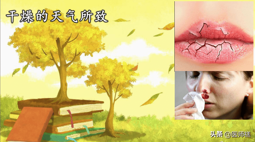 鼻子出血怎么回事儿