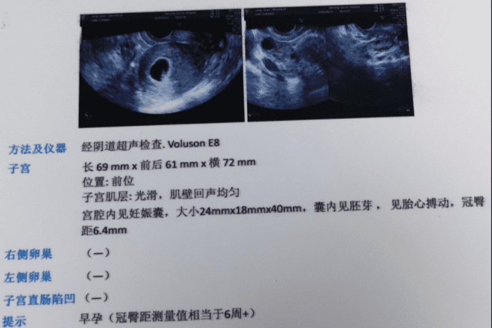 人流注意事项有哪些(人流要注意些什么)