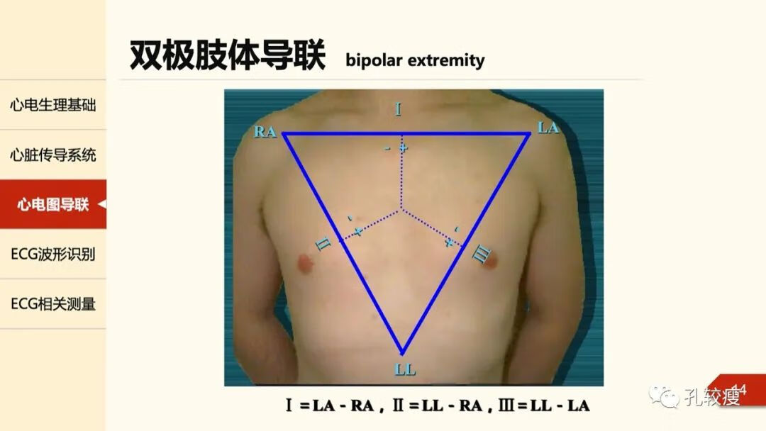 心电图导联位置示意图(心电图机导联位置图)