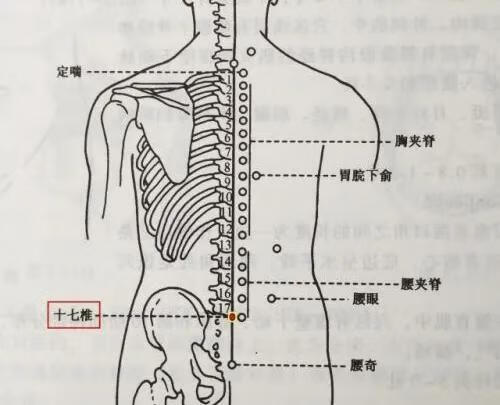 棘突炎疼痛位置图片图片