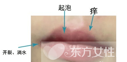 经常嘴上起泡是什么原因(嘴上面起泡是什么原因引起的)