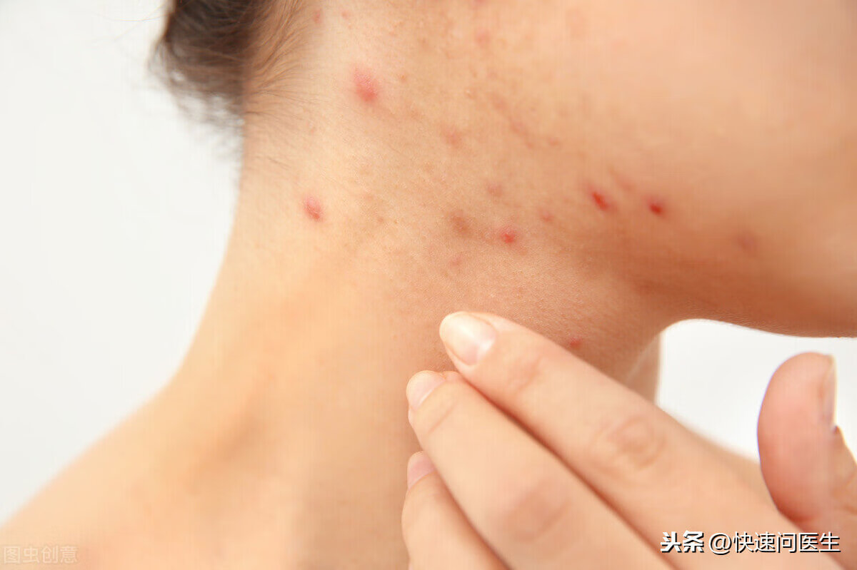手臂上有小红点点(胳膊上有红色的小点点)