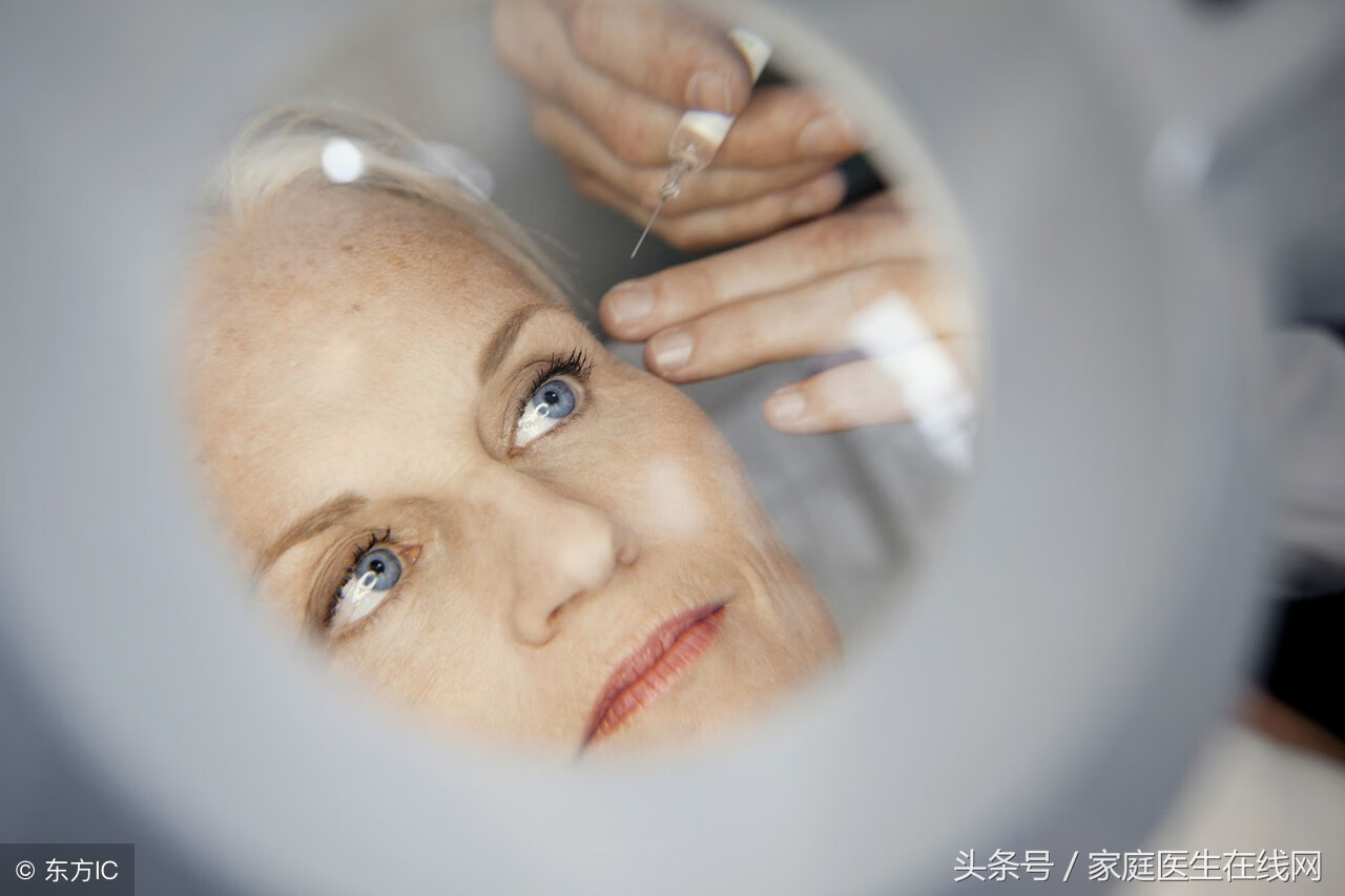 去鱼尾纹有效的方法(鱼尾纹严重用什么最有效)