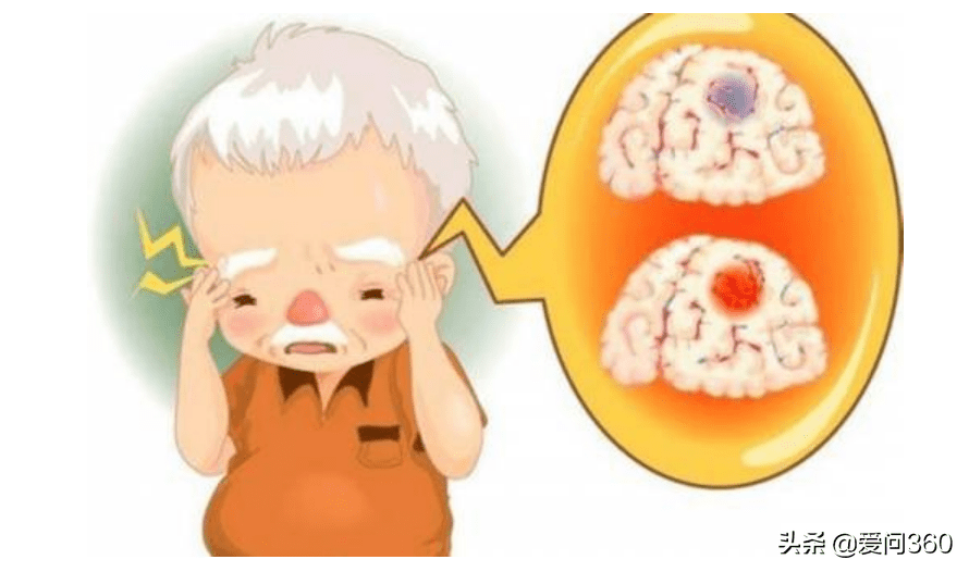 睡觉时脑供血不足什么症状(脑供血不足的早期症状)