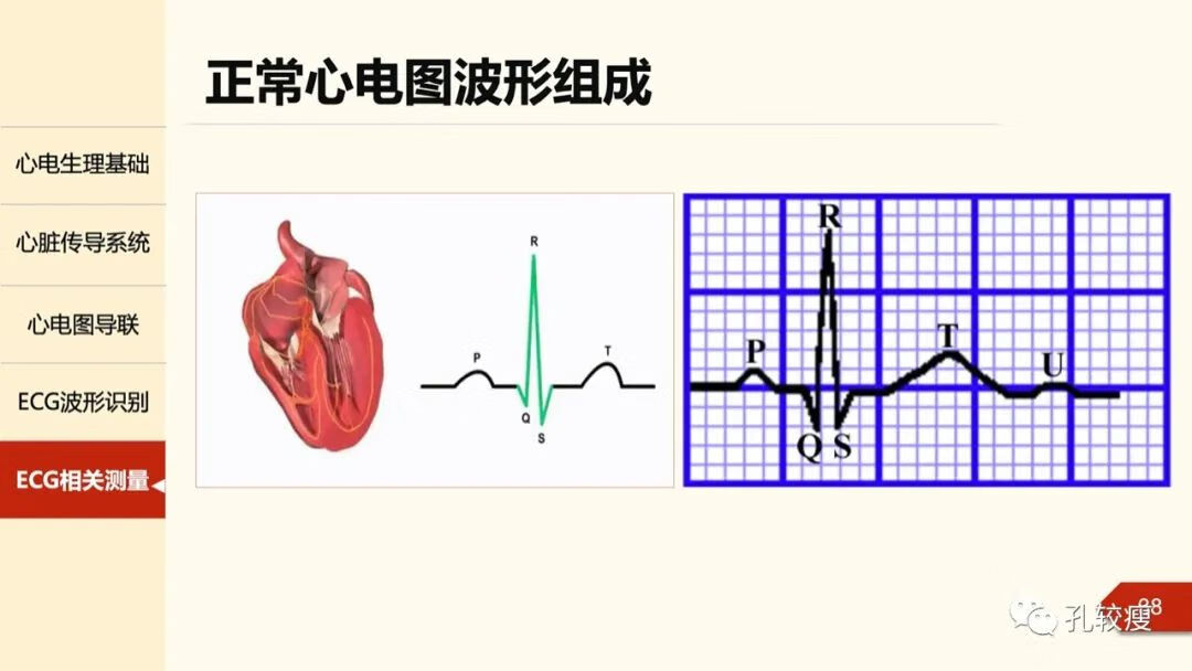 心电图导联位置示意图(心电图机导联位置图)