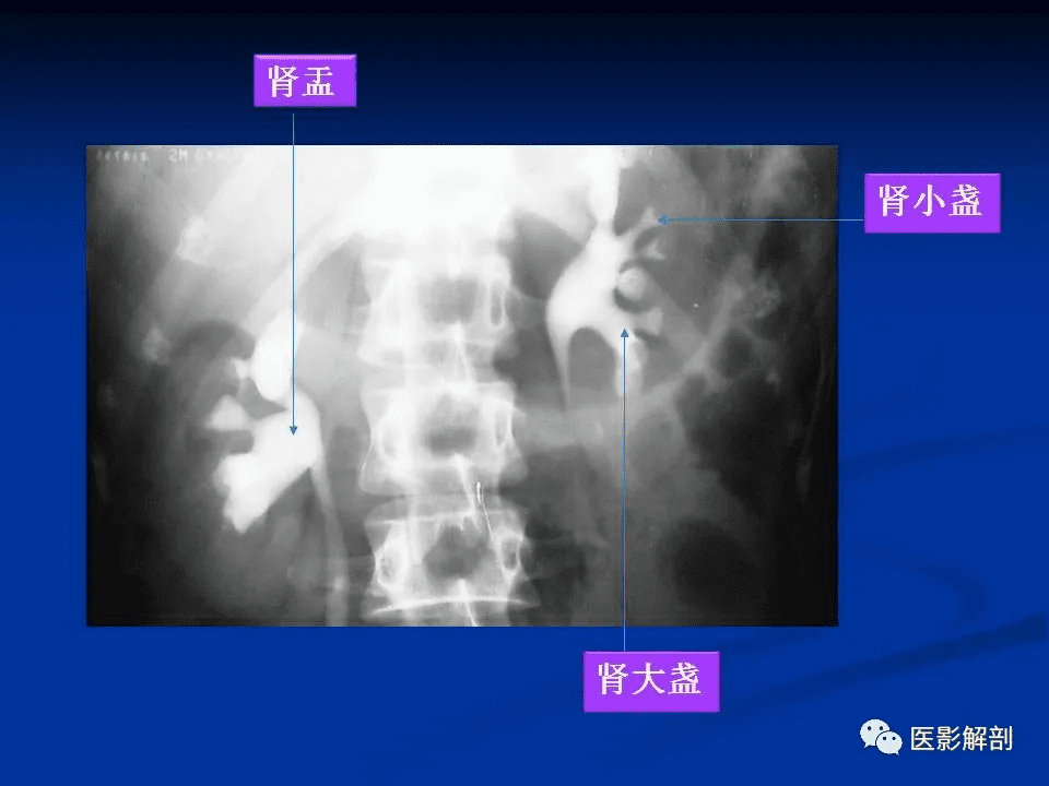 泌尿外科是什么科 泌尿科都看什么病?