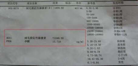 早早孕测试最佳时间是几点(测早孕一天中最佳时间)