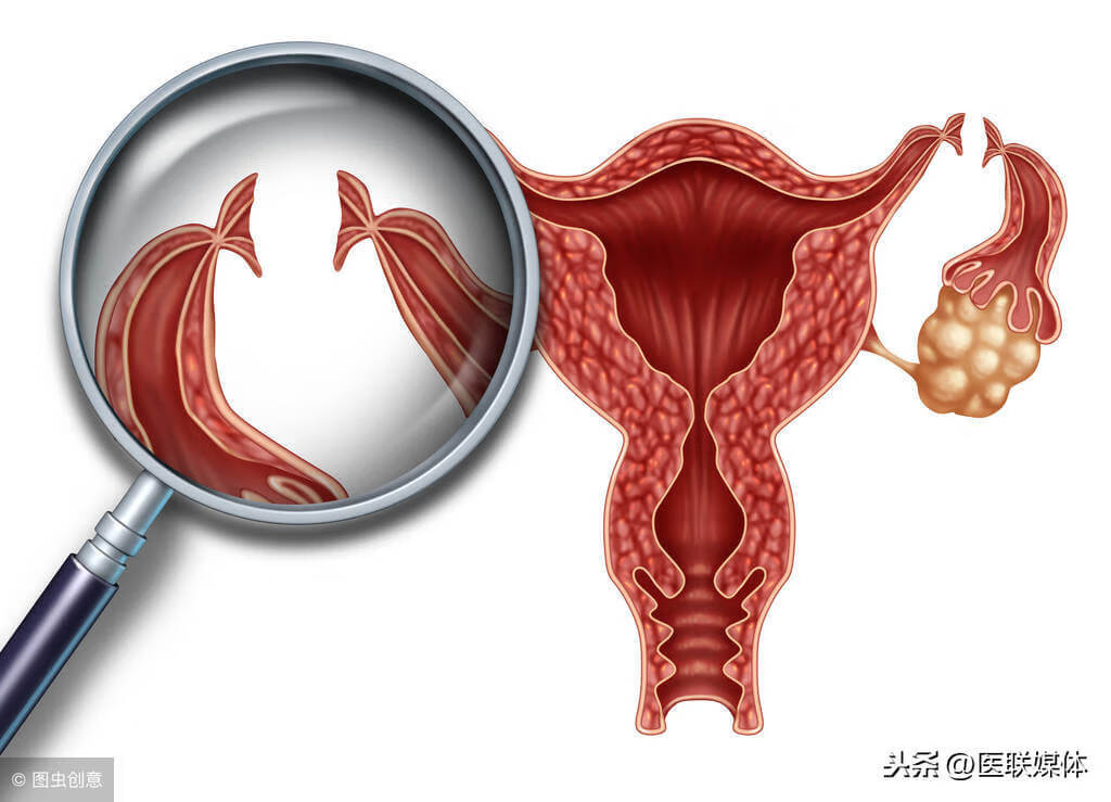 卵泡破裂怎么回事卵泡破裂是怎么回事