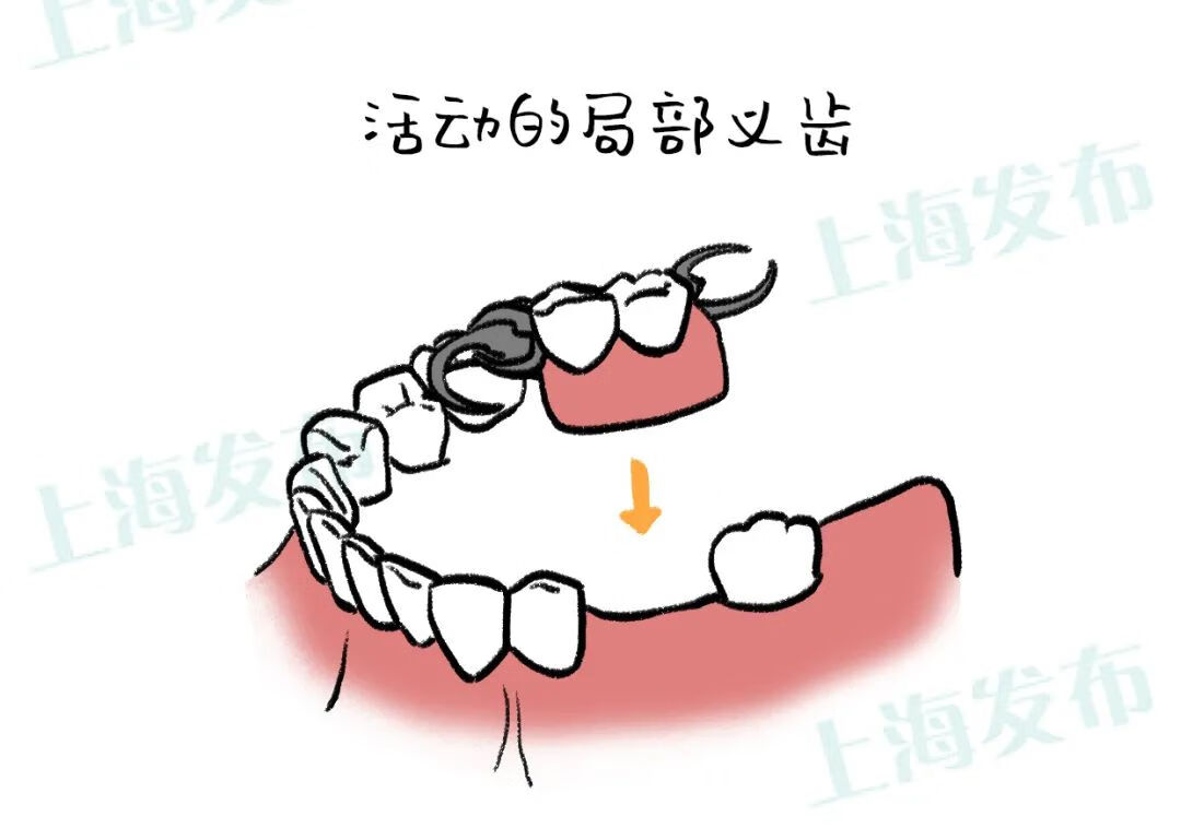 牙神经痛怎么解决(牙痛到神经痛怎么办)