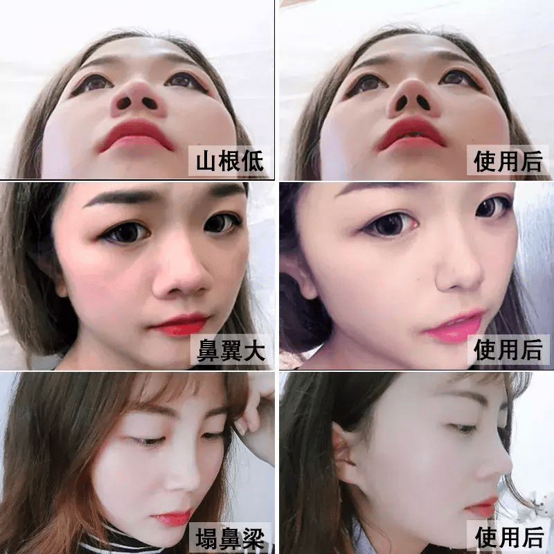 隆鼻精油吧(隆鼻精油真的有用吗)