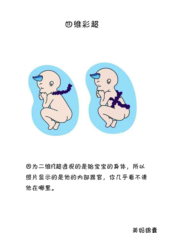 四维彩超啥时候做最好(最后一次四维彩超什么时候做)