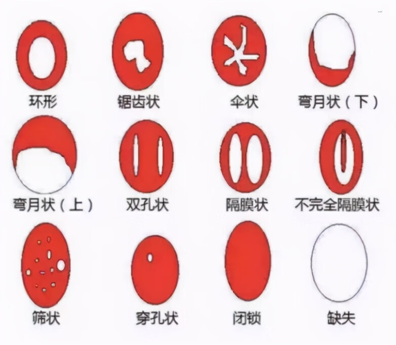 处钕膜(处nu膜是什么)
