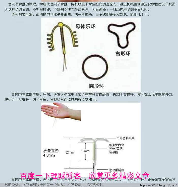 避孕环的放置位置图(避孕环怎么上)