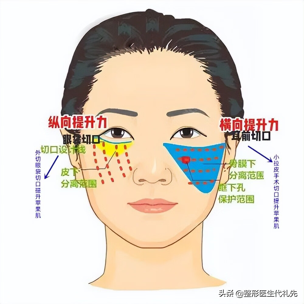 祛除眼袋方法(6种方法有效消除眼袋)