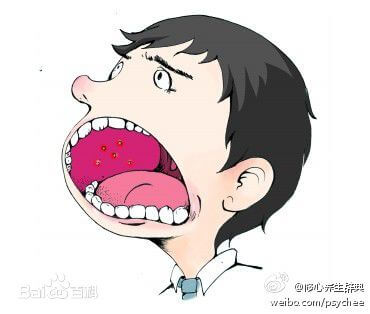 上火症状有哪些(上火会发生什么症状)