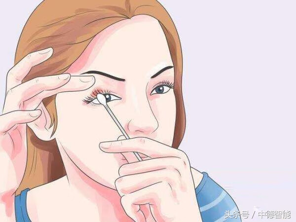 眼睛长针眼怎么办?(眼睛长针眼了怎么快速解决)