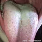 海螵蛸的副作用是什么(海螵蛸副作用都有哪些)