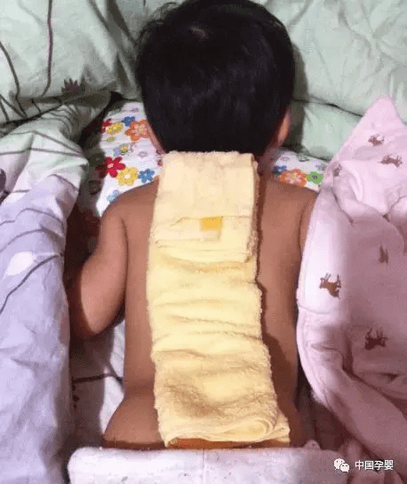 宝宝反复发烧怎么办?(宝宝一直持续发烧怎么办)