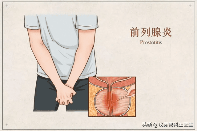 什么叫前列腺炎图片(前列腺在什么位置)