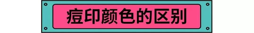 如何消除痘印小妙招(教你4个淡化痘印的有效方法)