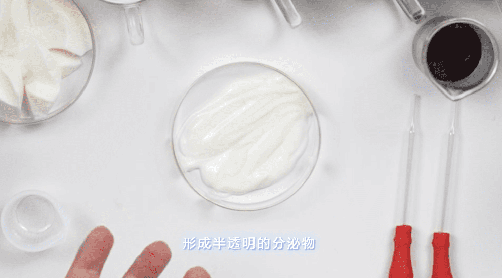 白带(白色豆腐渣分泌物照片)