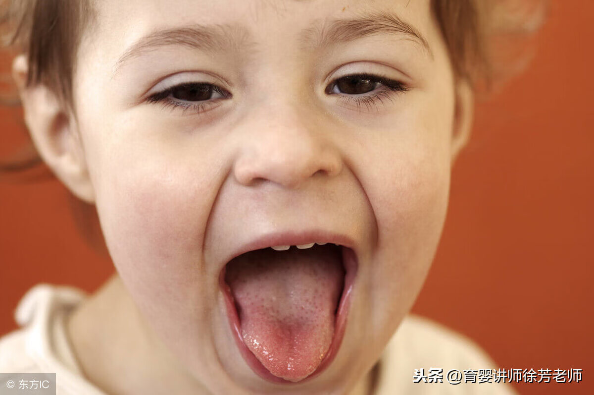 2个月宝宝口腔溃疡怎么办(婴儿长口腔溃疡怎么办)