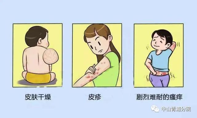 慢性湿疹图片(急性湿疹自己能好吗)