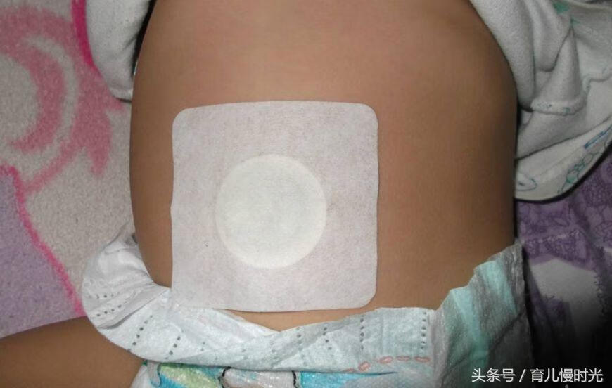 小儿腹泻贴贴哪里(小儿腹泻贴有用吗)