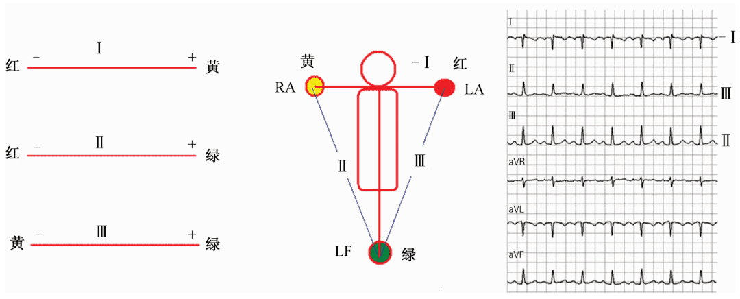 心电图导联的位置是(心电图全导联位置图)