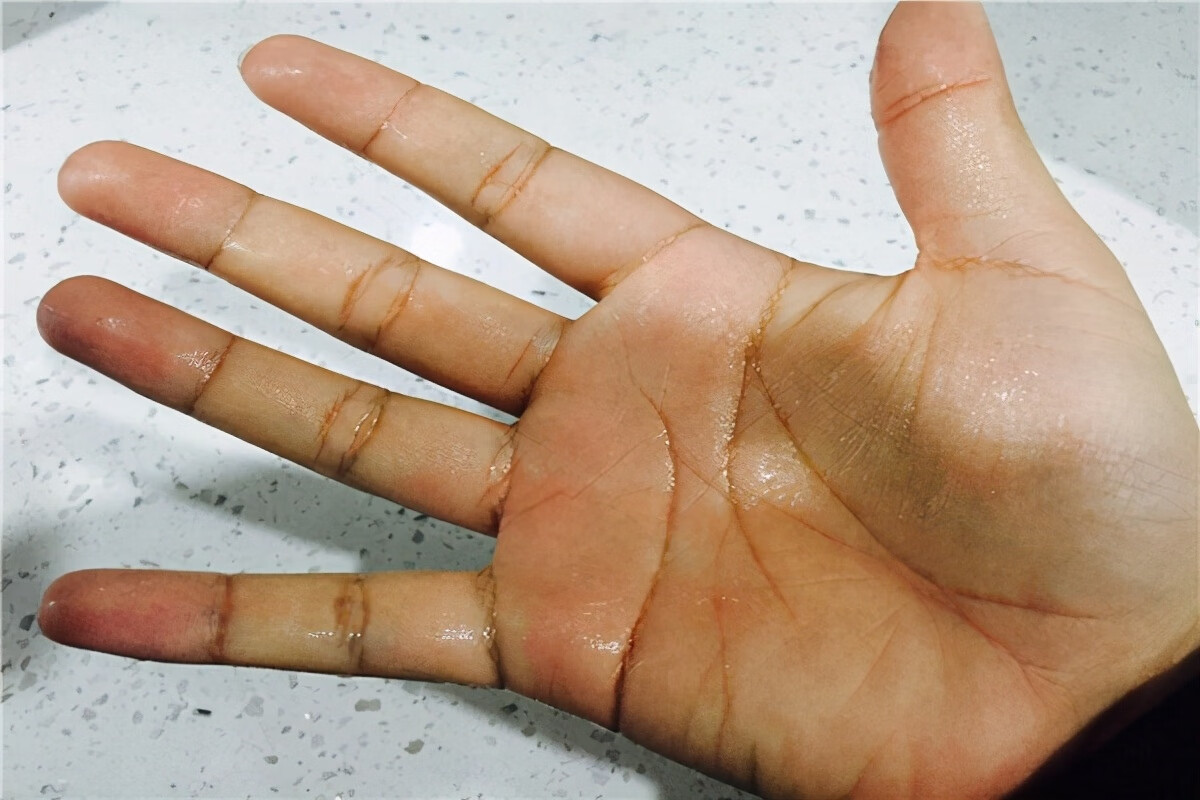 女人更年期症状一般会持续多久(女人更年期会出现什么症状)